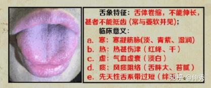 中医舌诊详解大全(独家讲义) - 知乎