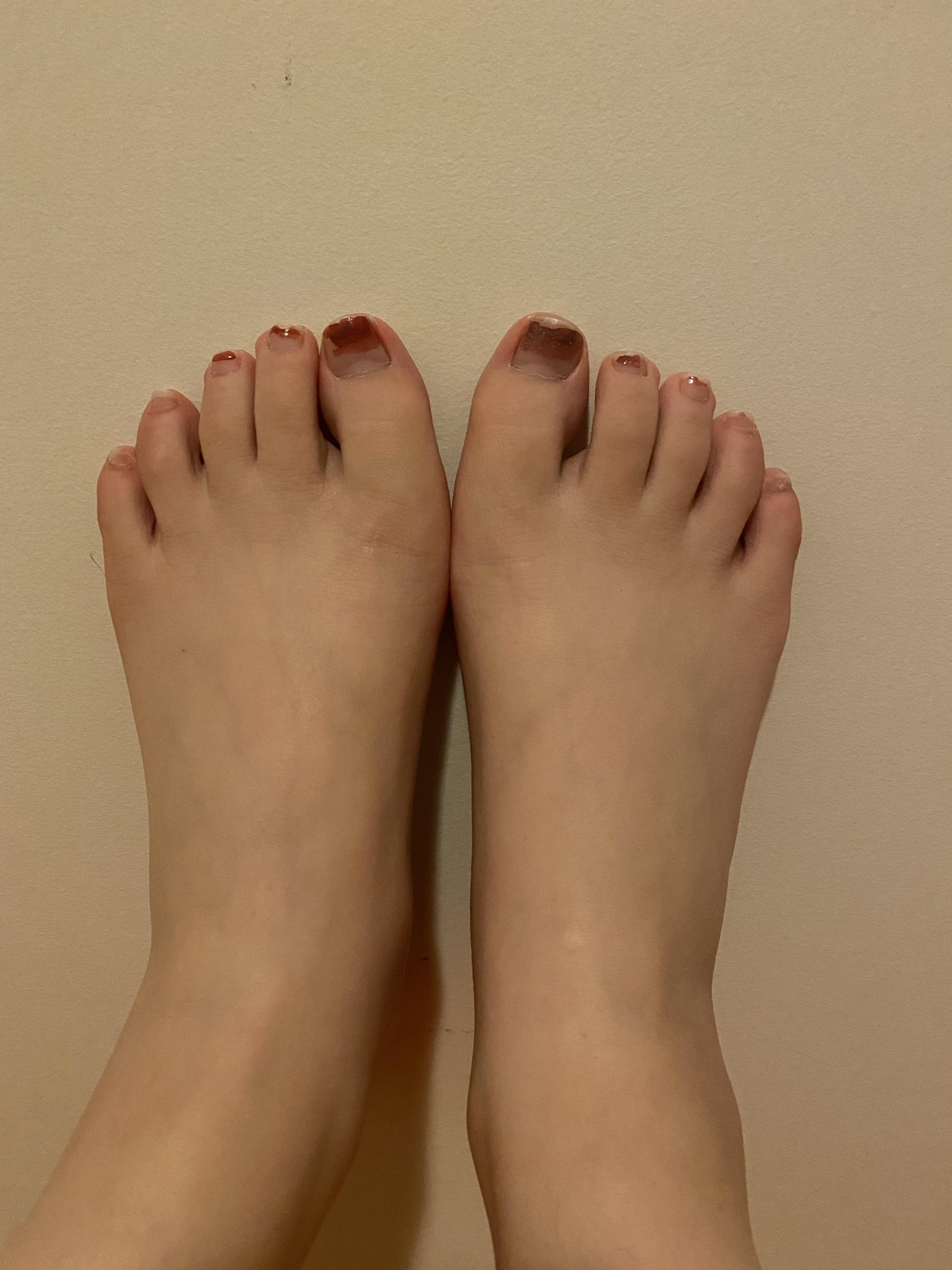 女生拥有一双罗马脚是什么体验