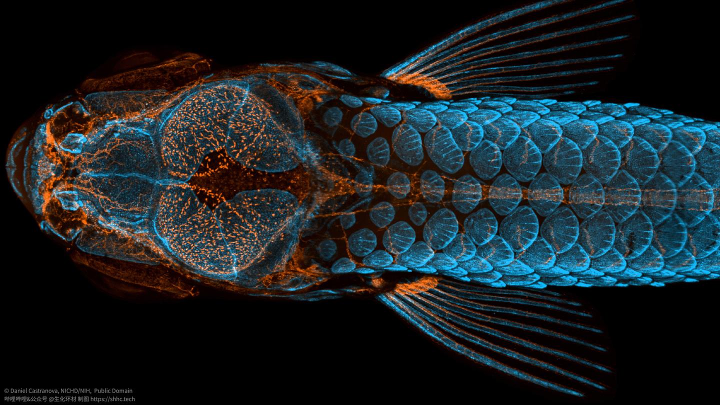 科学网—用imageJ分析斑马鱼成骨染色平均荧光强度和IOD - 玉一岚的博文