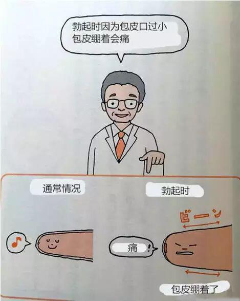 男生包茎一定要割包皮吗? - 知乎