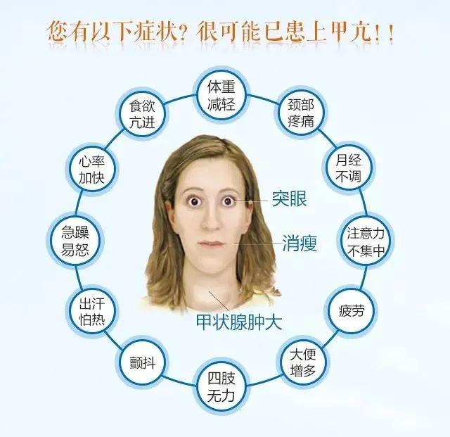 甲亢、甲减……怎么办?甲状腺功能检验报告单,一表读懂! - 知乎