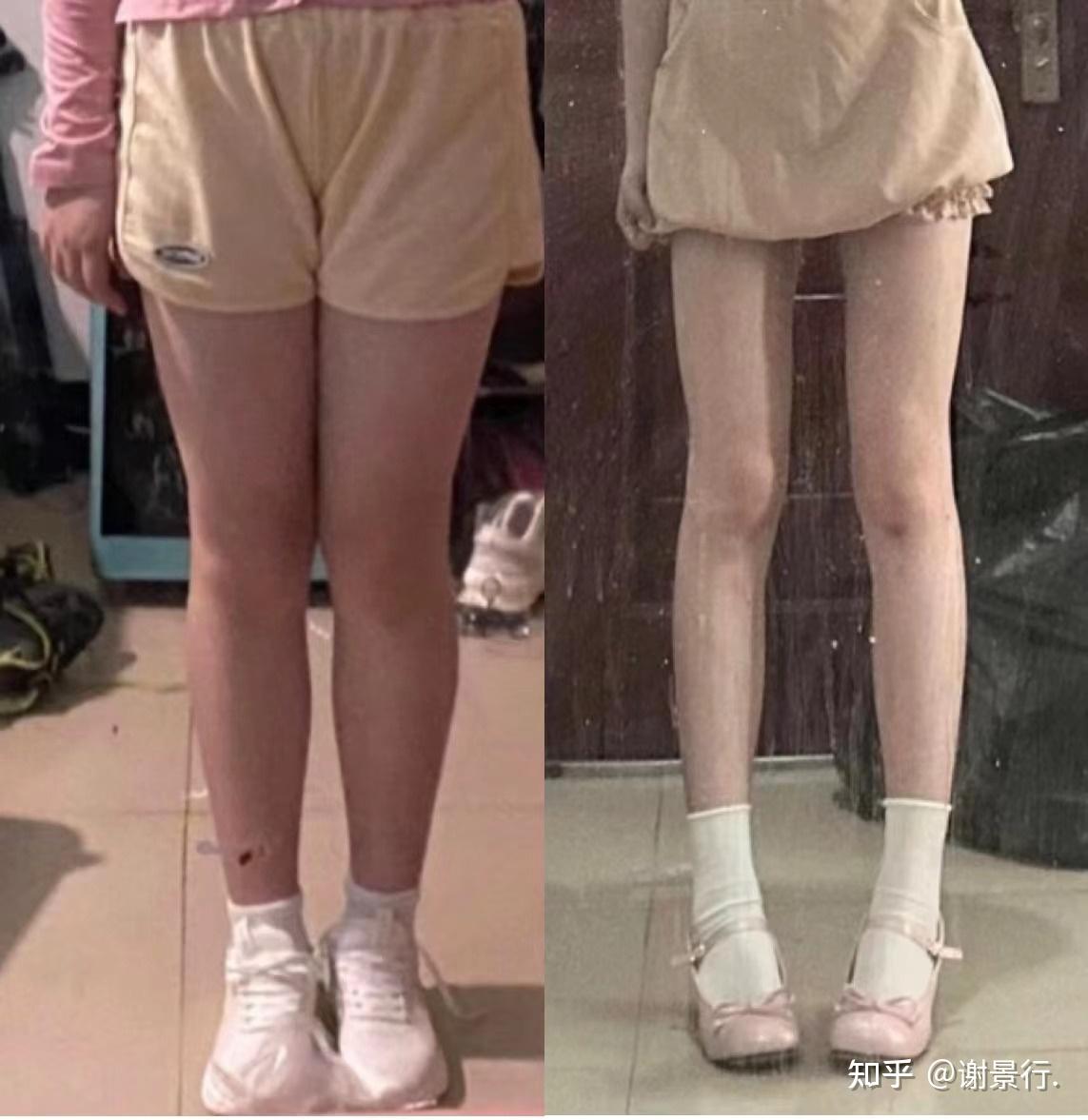 女生身高158体重88斤想瘦到82斤有什么方法吗