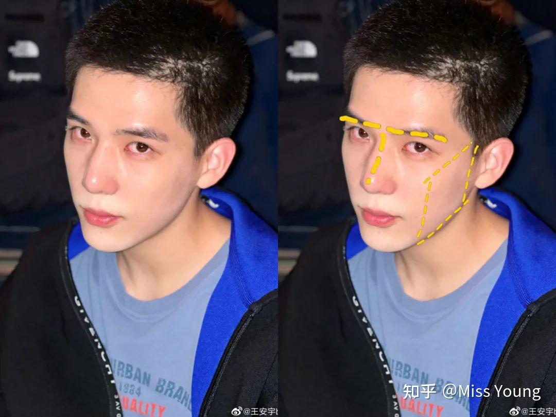 王安宇是不是整容了? - 知乎