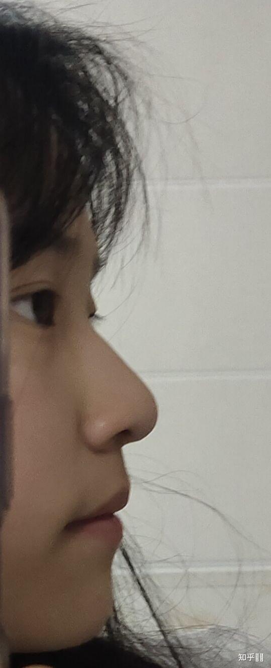 鼻子挺但不好看是种什么体验? - 知乎