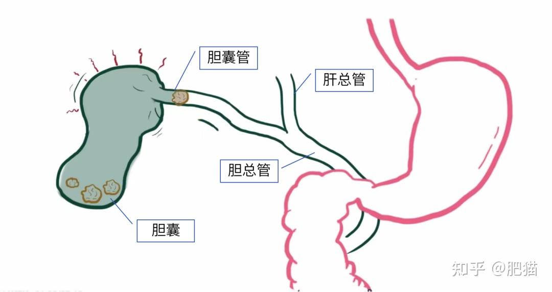 阑尾和胆囊示意图图片