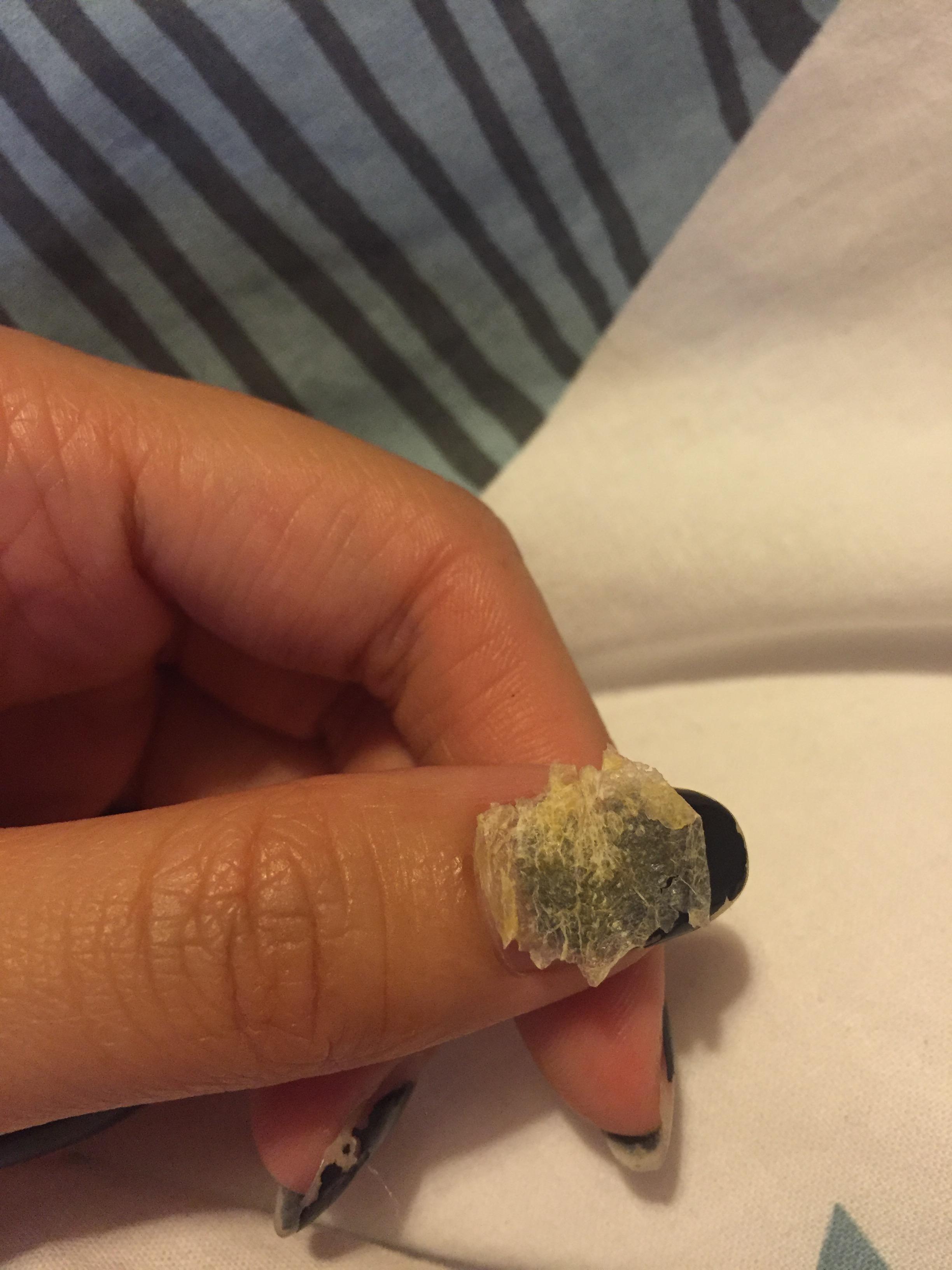 为什么我掏出来的耳屎是桶状的,就是一层薄膜粘附在耳壁上? - 知乎