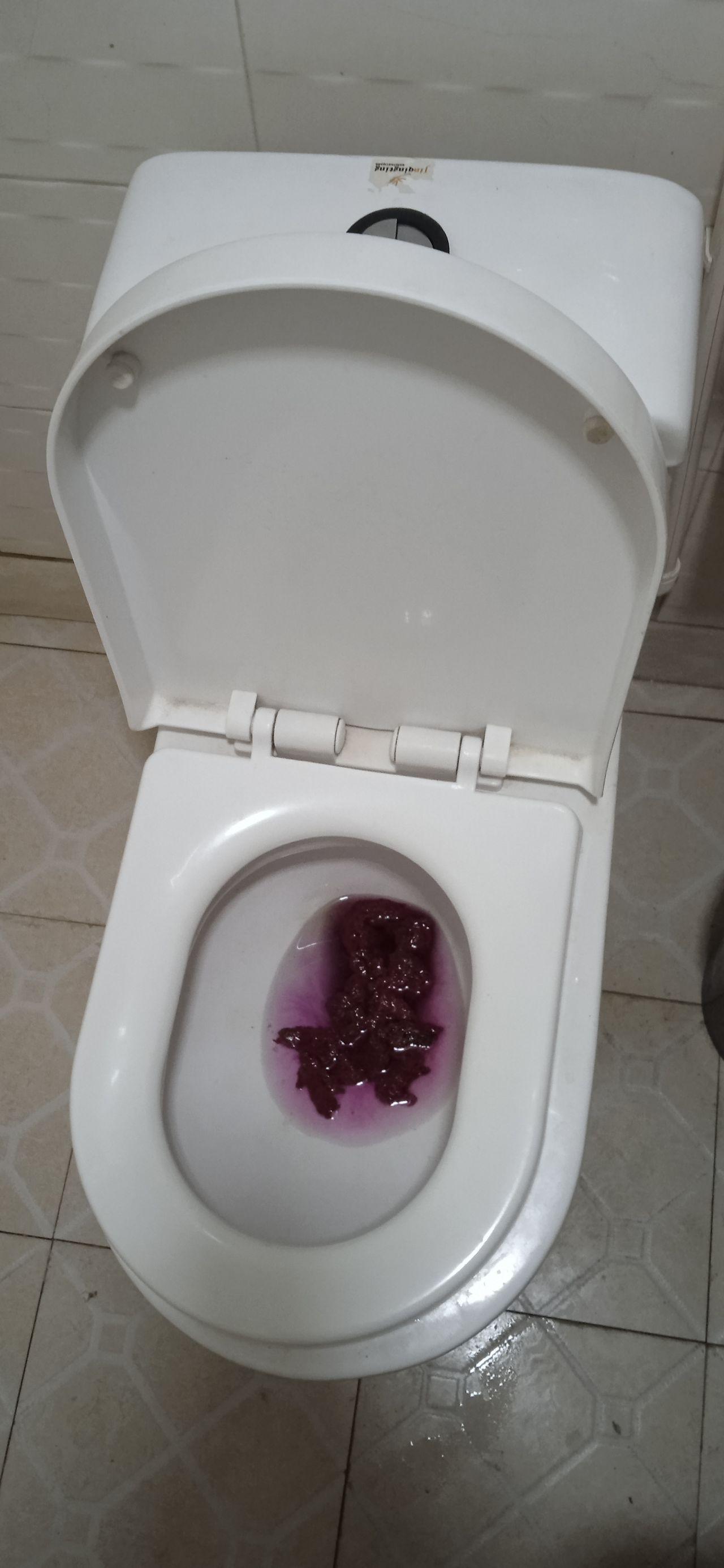 你们拉过颜色最诡异的屎是什么颜色? - 知乎