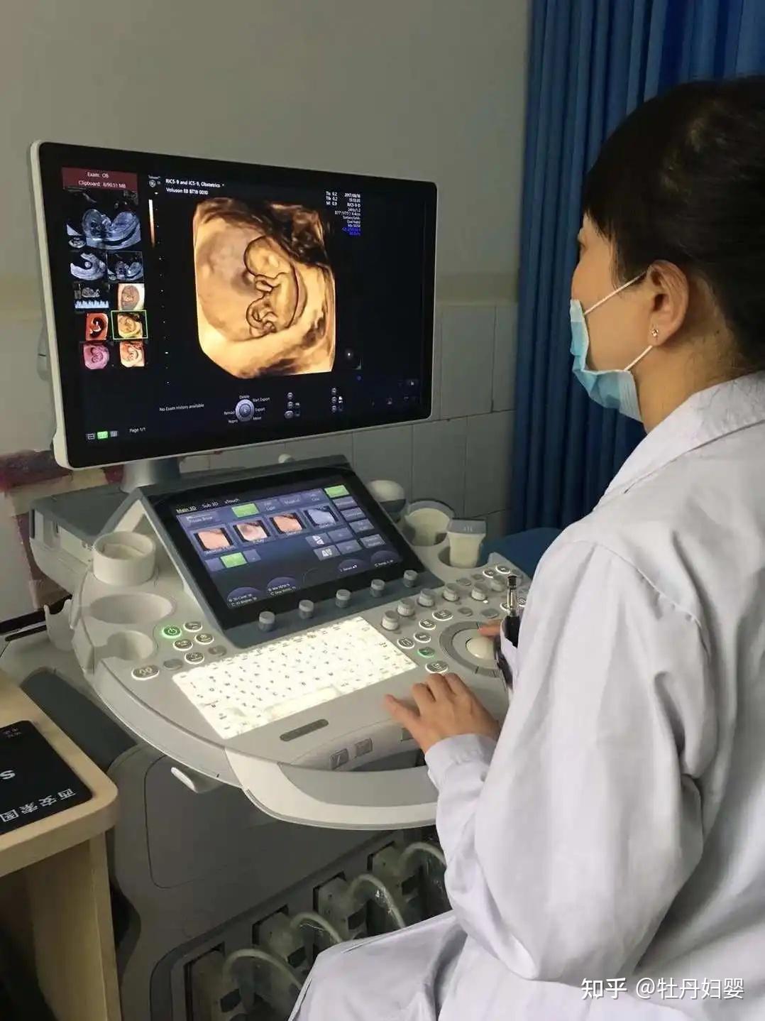 孕妇四维检查的注意事项有哪些?