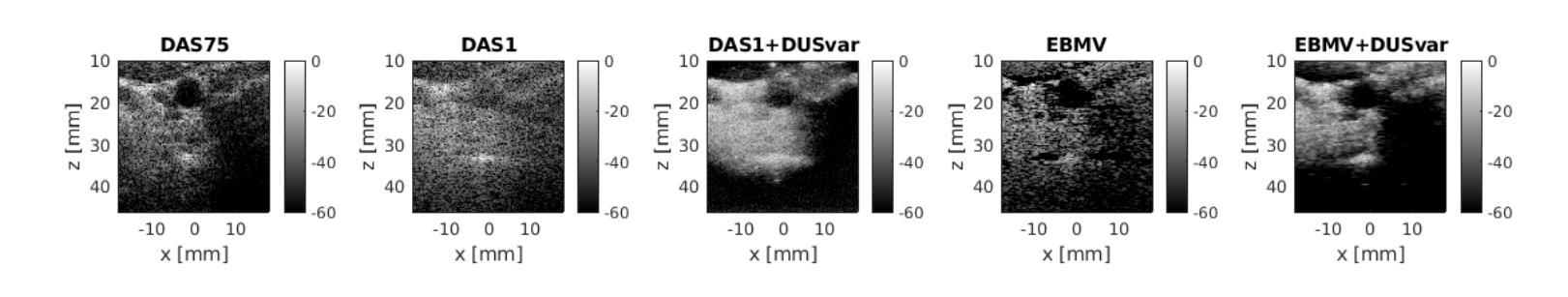 Diffusion Models