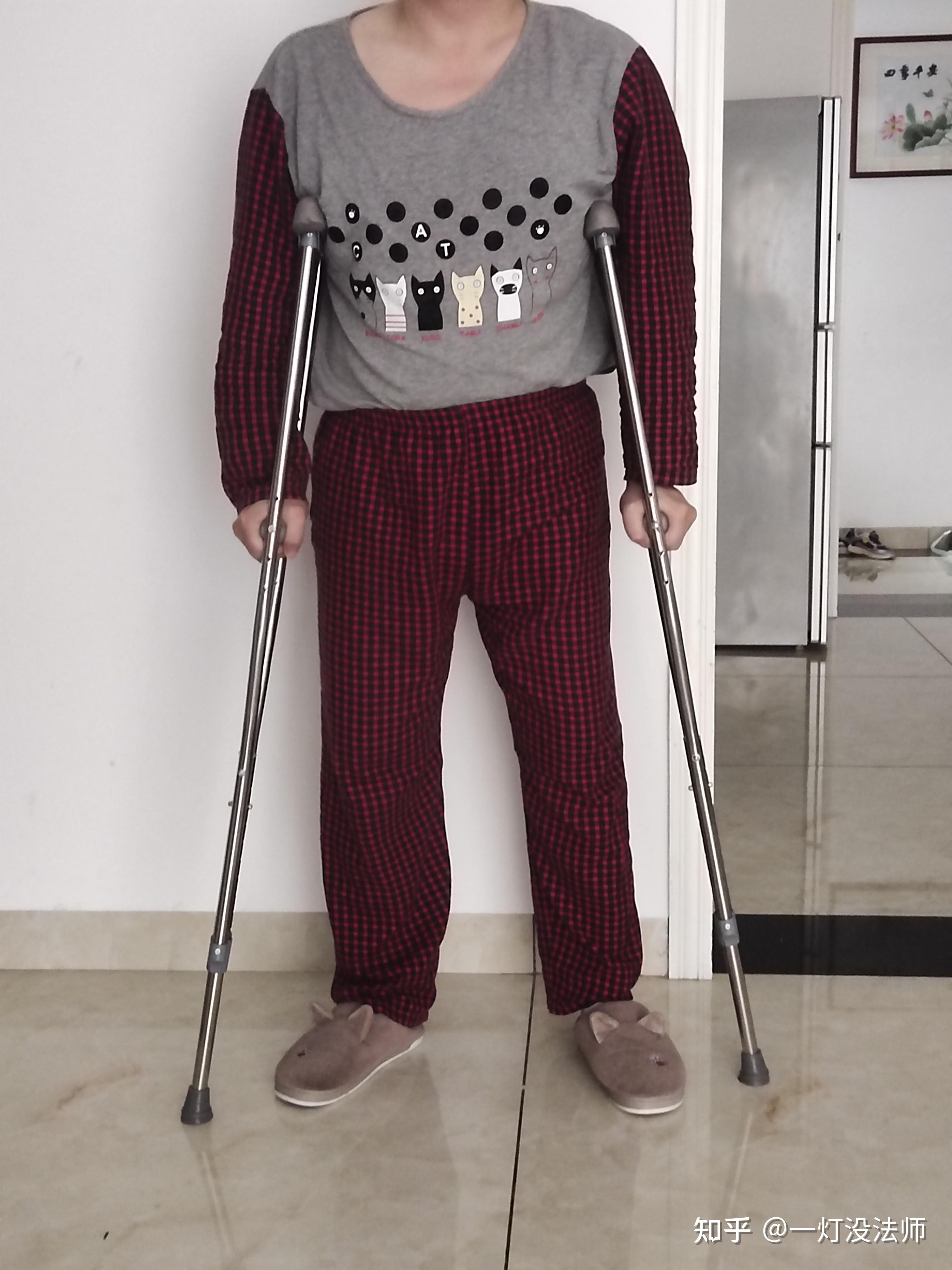 大家腿骨折杵拐杖不累麽? - 知乎