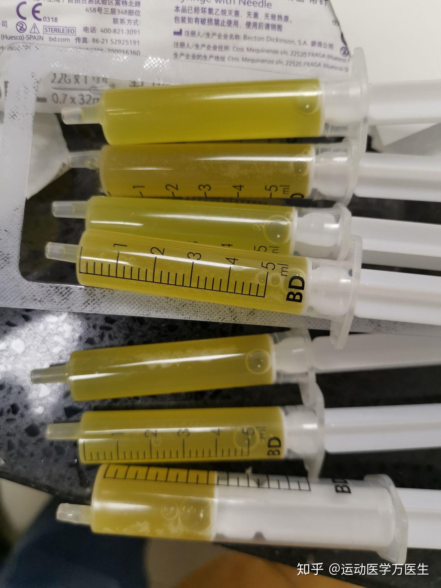 膝盖积液是什么可以喝吗