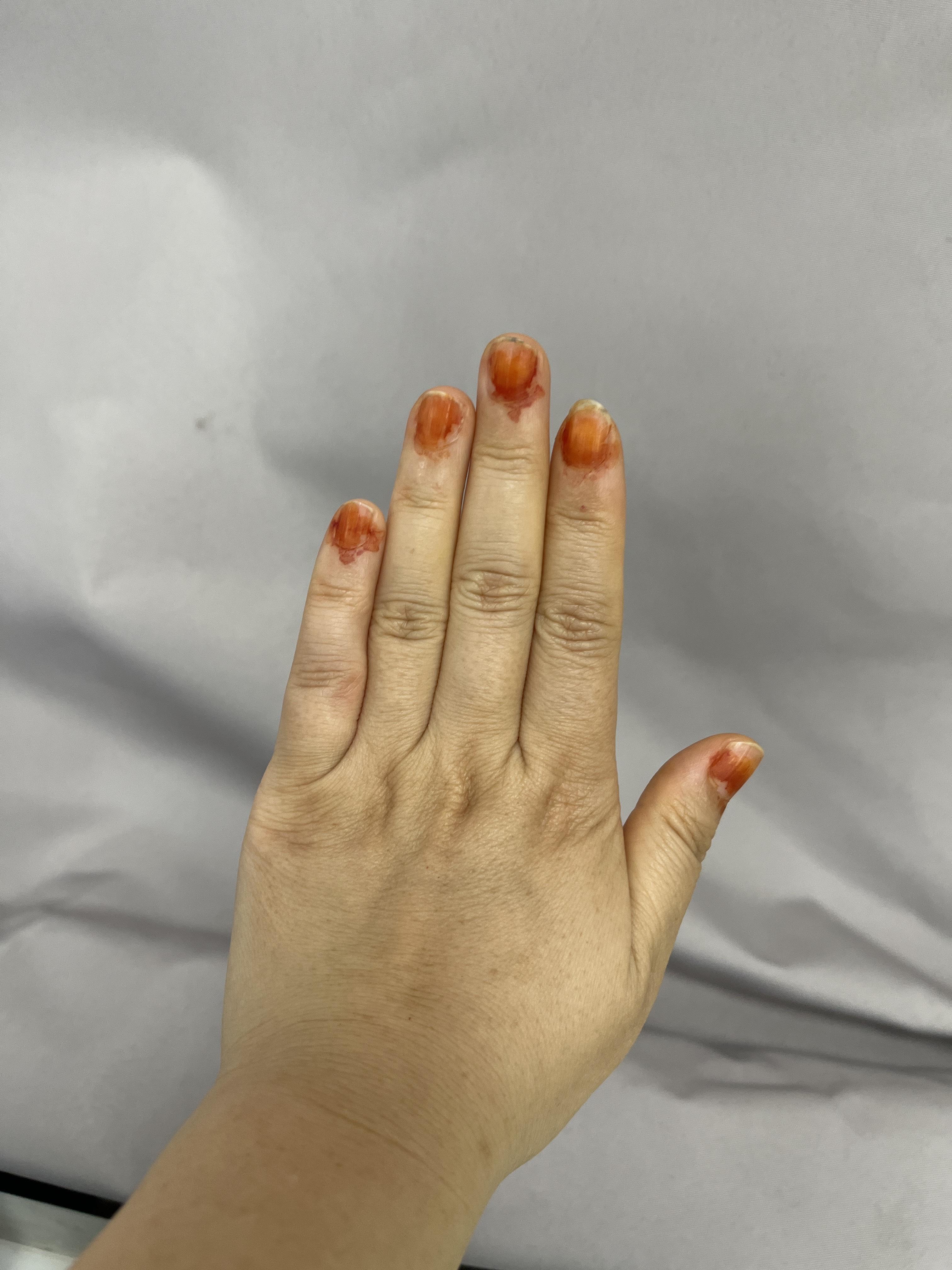 凤仙花染指甲是种什么体验? - 知乎