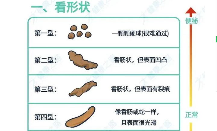 排便像这样，是肠道出现问题了吗？ - 知乎