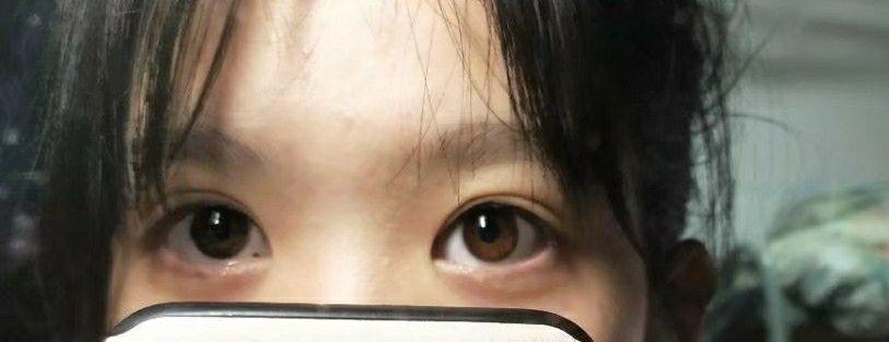 有和我一样天生绿眼睛的中国人么