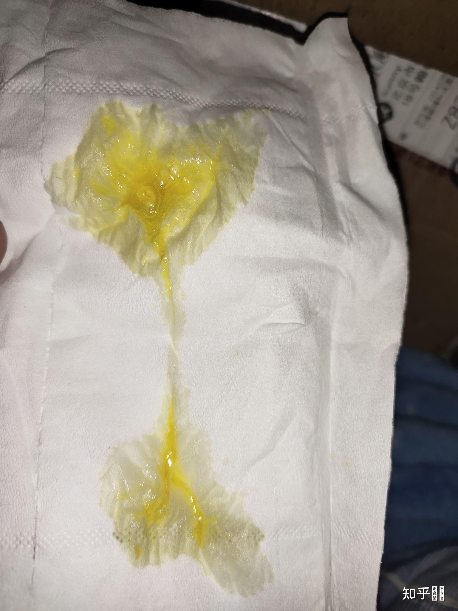高质量的为什么射精是黄色的的图像