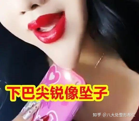 为什么整容