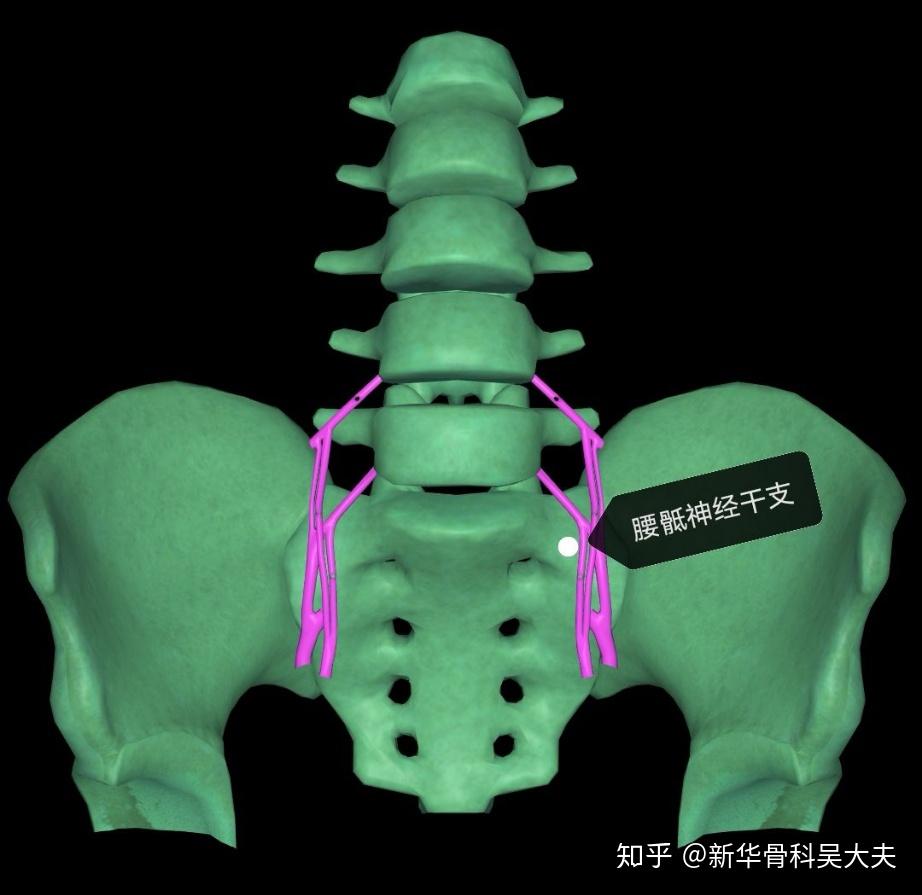 腰5骶1突出和腰45节突出哪个更严重