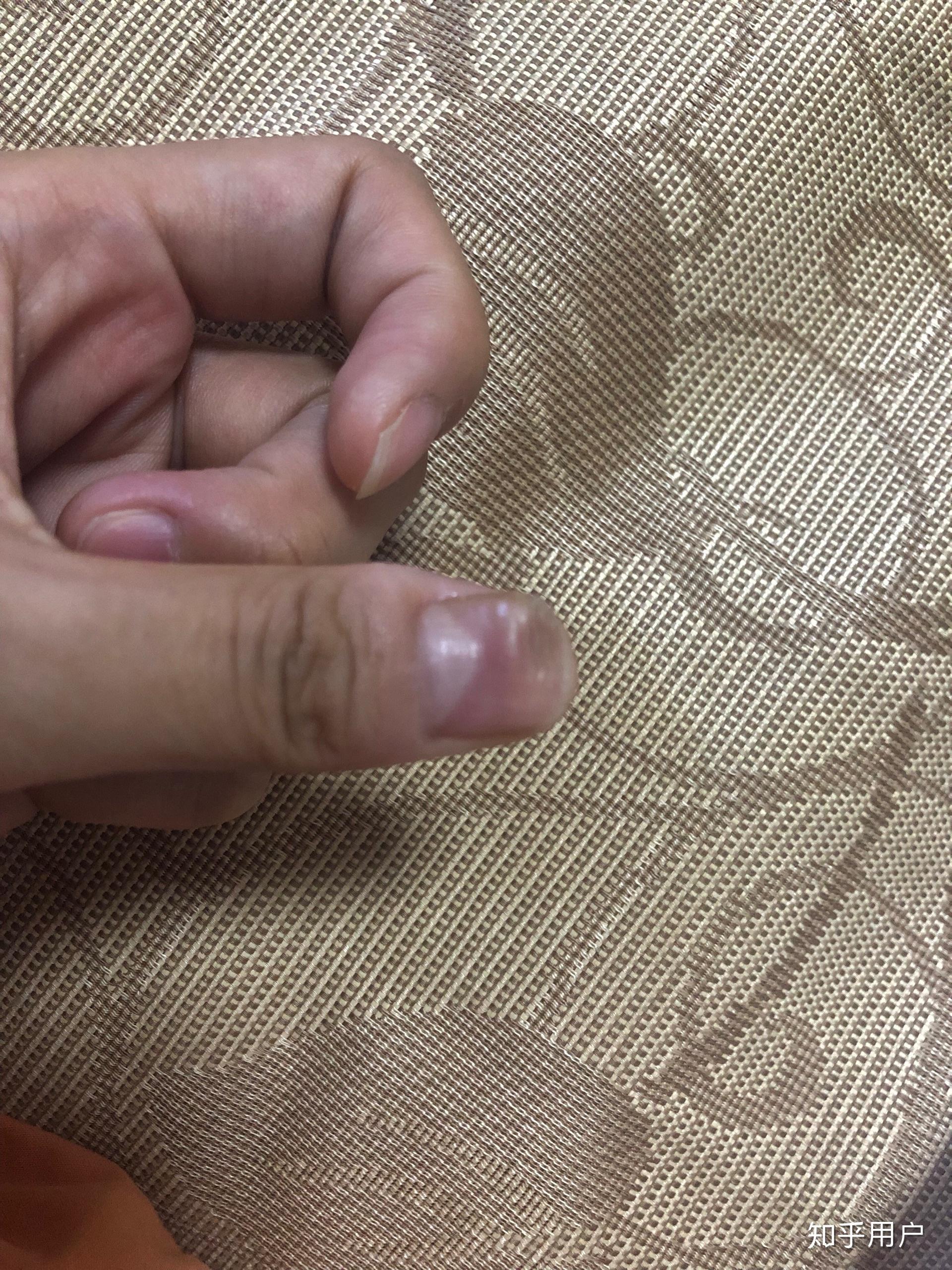 大拇指指甲凹陷图片