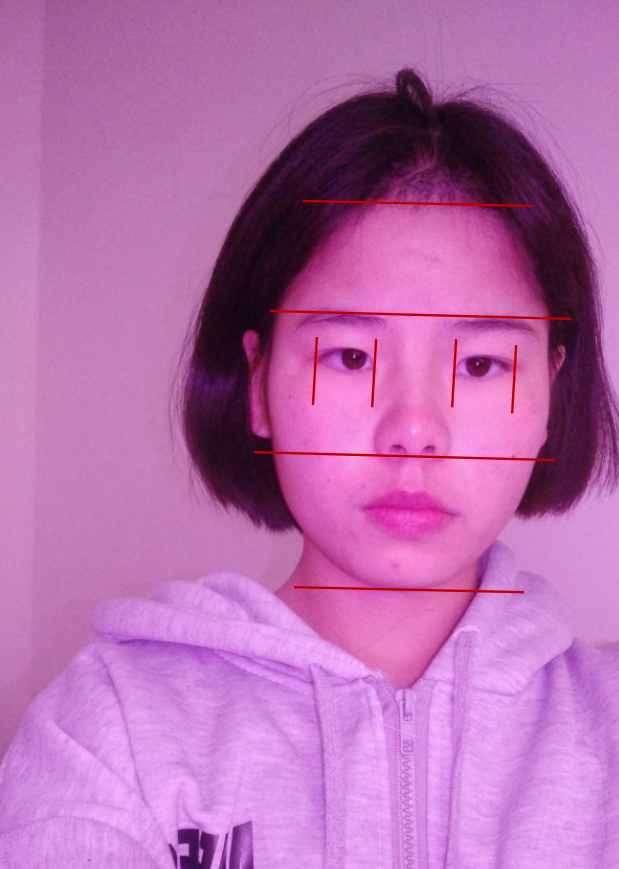 请问我的颧骨高吗?