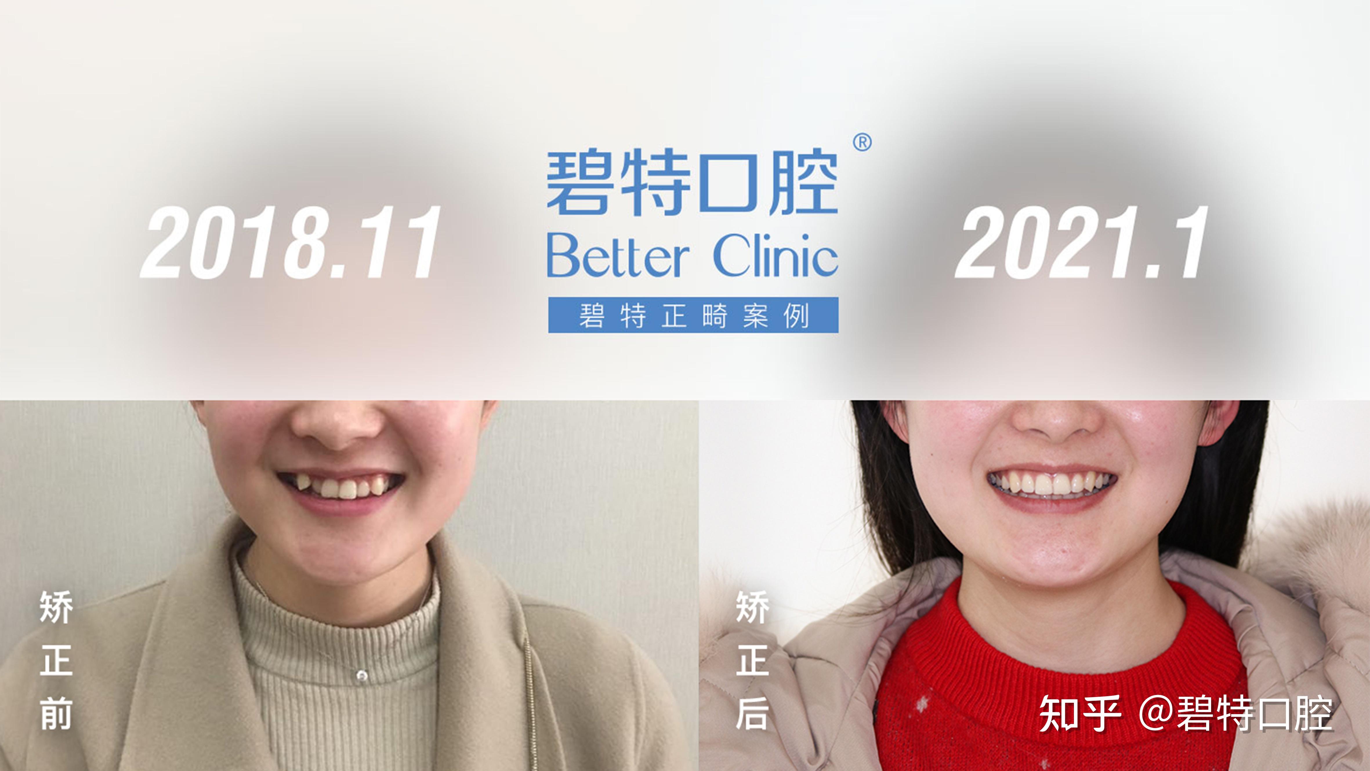 天堂长个牙齿怎么办