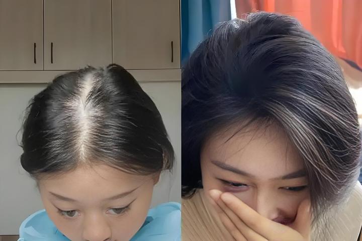 生发液什么牌子最有效果?解锁育发液排行榜第一名 - 知乎