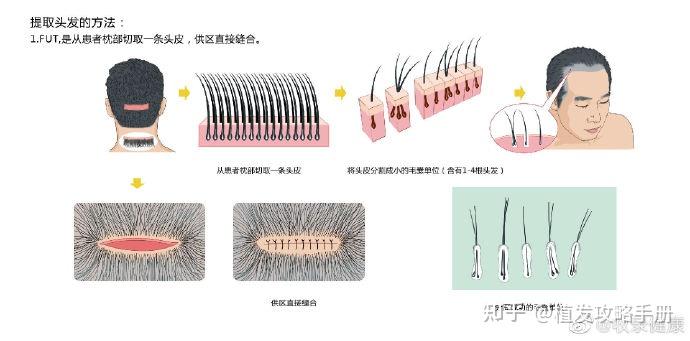 关于长春植发医院的信息
