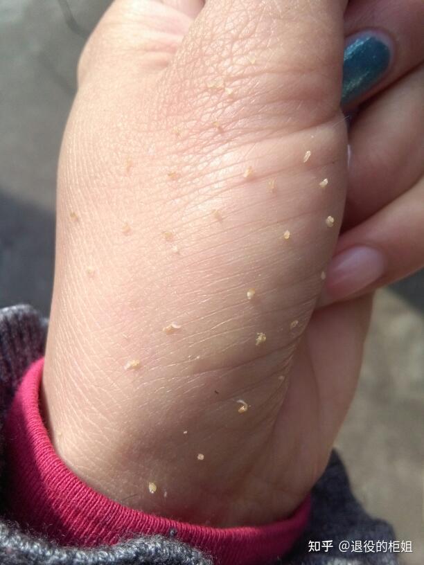 怎么才能控制抠鼻子