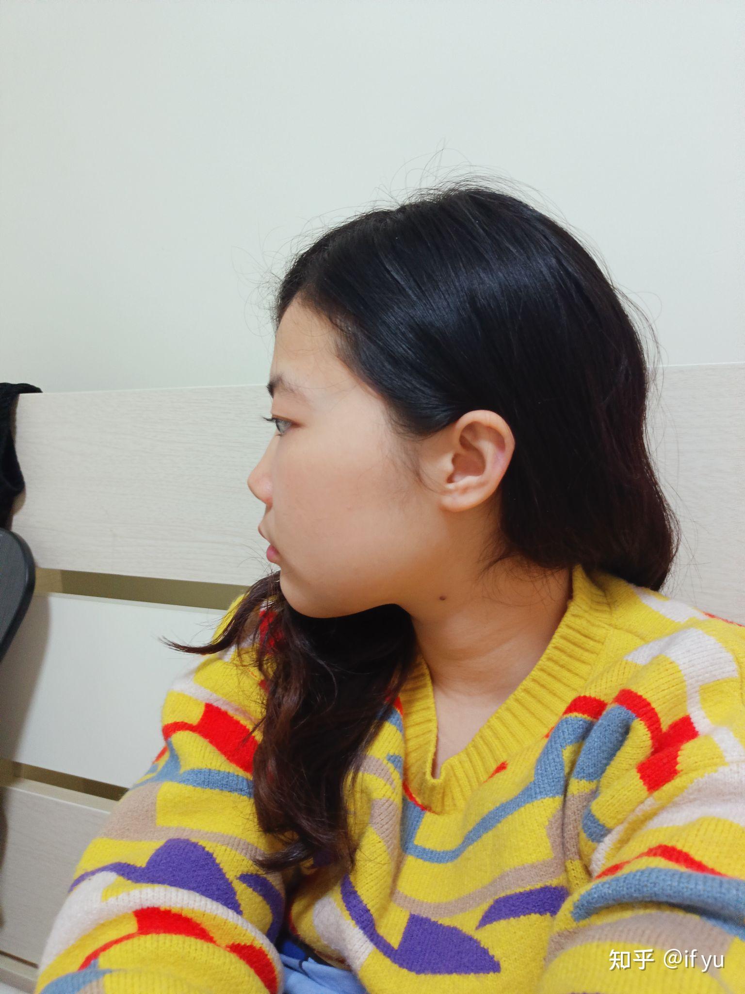 正脸好看但侧脸丑到爆是种怎样的体验