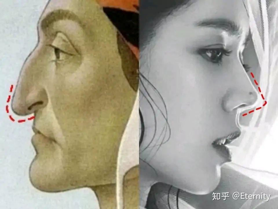 鼻子高但是山根低是什么样