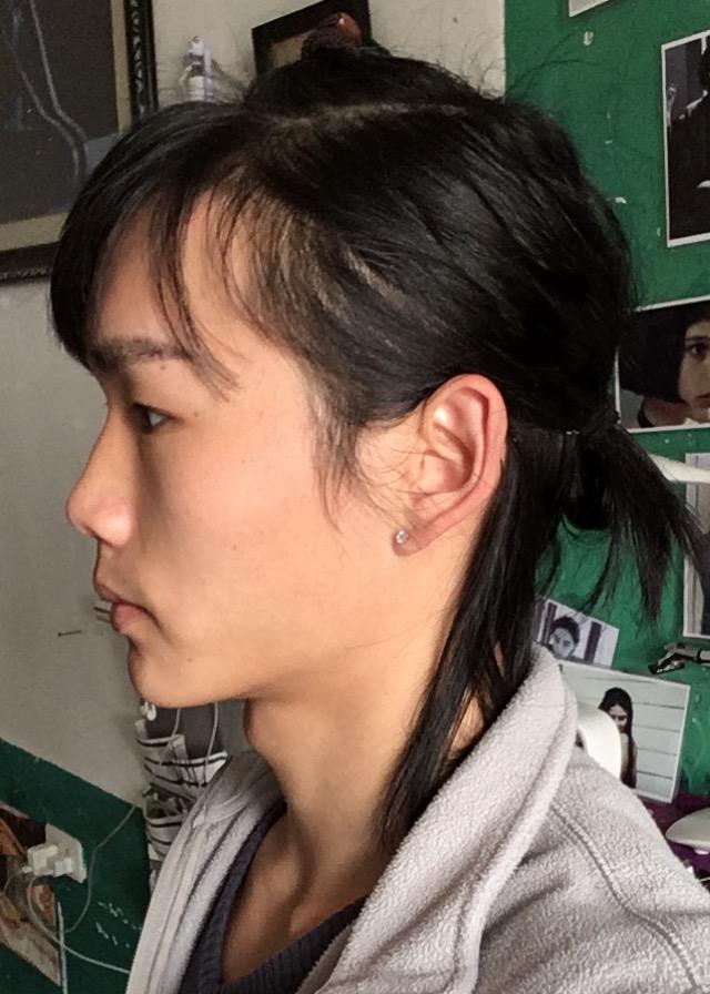 天生上唇短的人怎么办