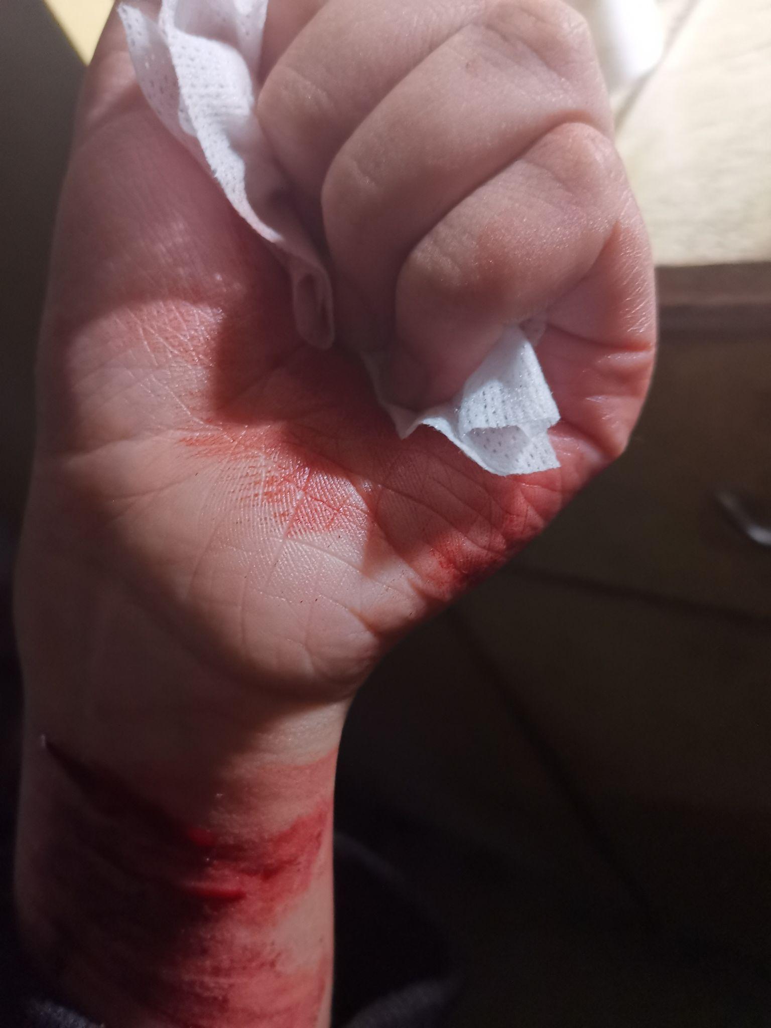 自残属于什么心理