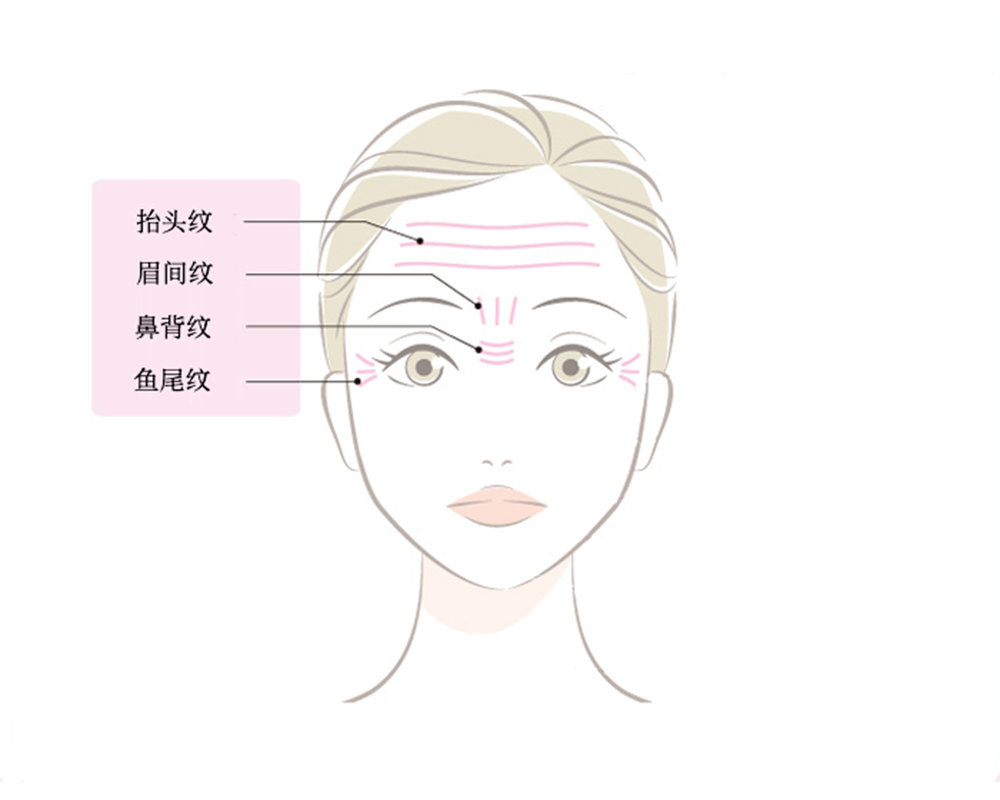 额头除皱针的注射图解图片