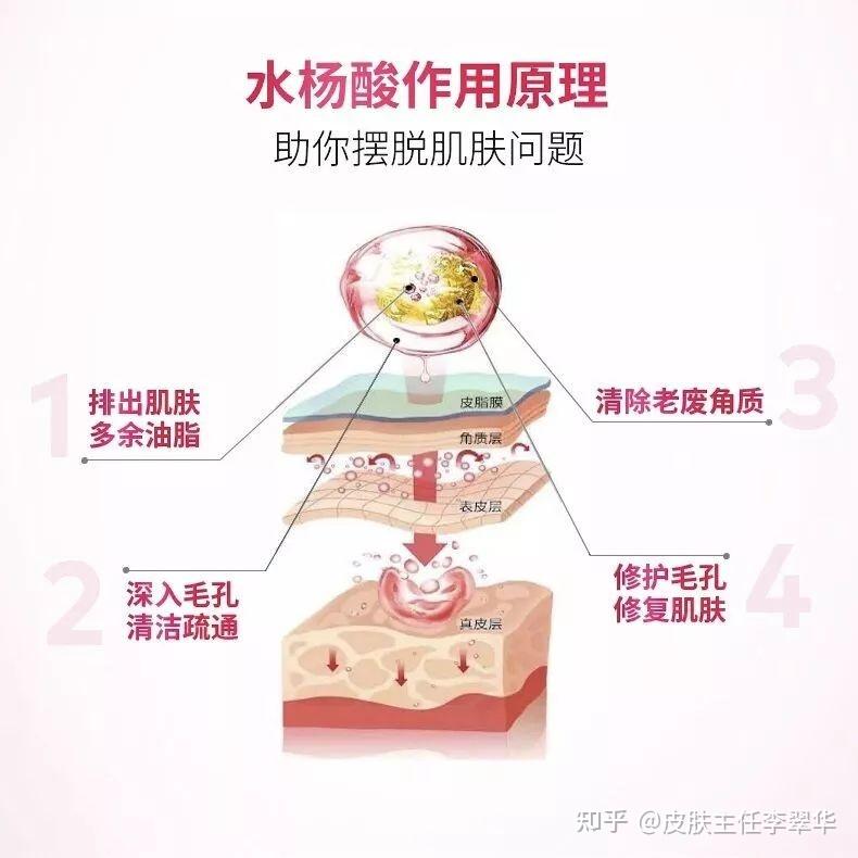 刷酸会烂脸吗? - 知乎