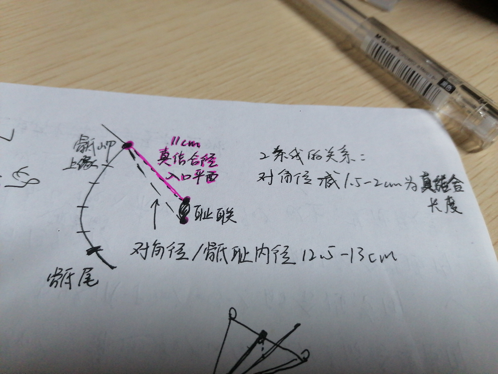 骶耻内径测量图片图片