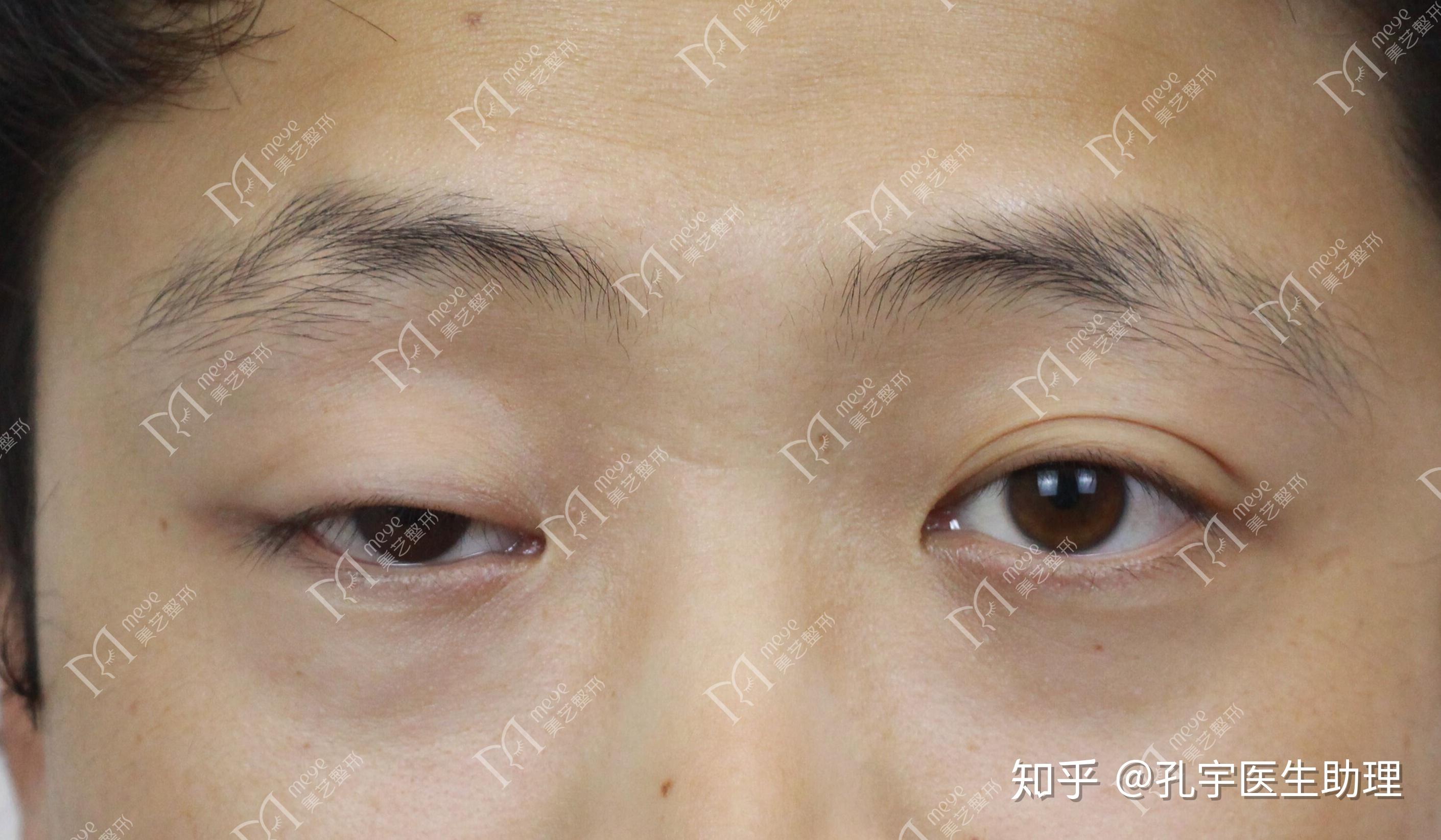 眼睛一大一小一单一双该怎么通过化妆来弥补? - 知乎