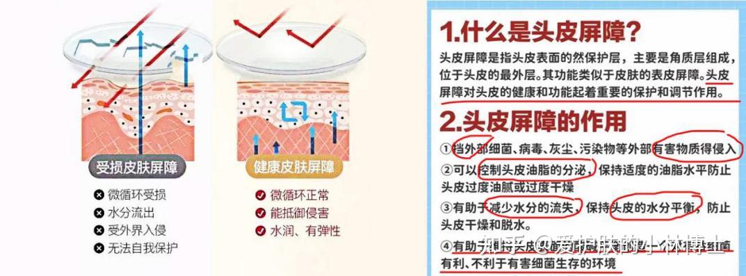 男生头皮不停地长红色小疙瘩,抠了还有血痂,到底怎么彻底解决? - 知乎