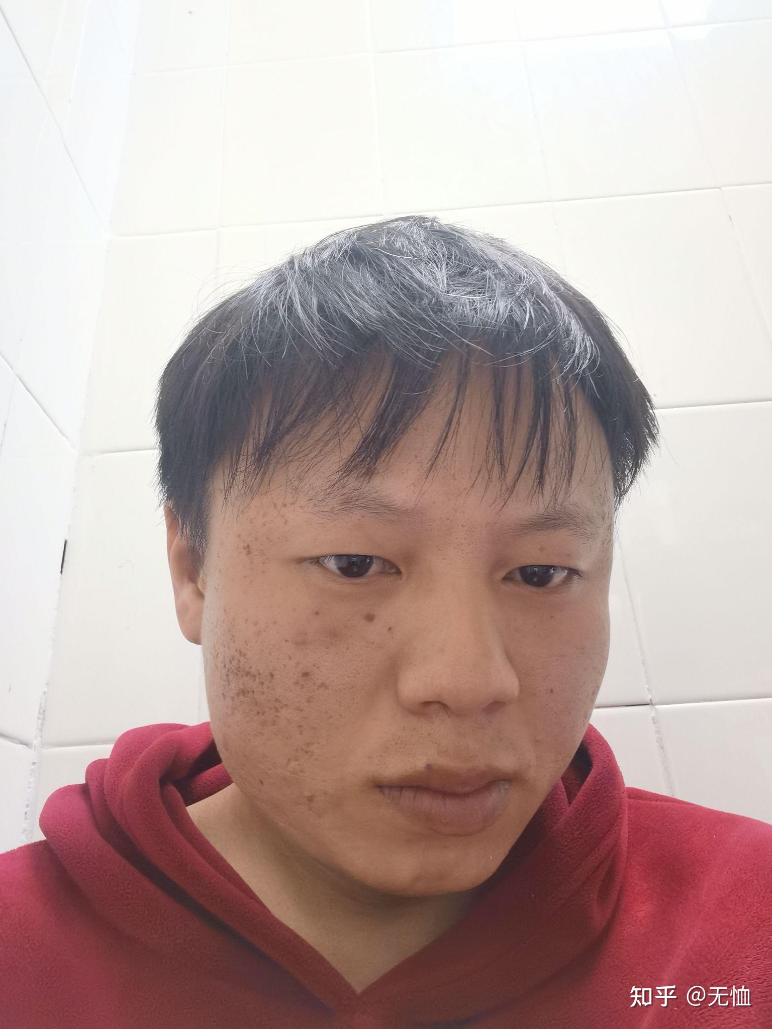 有没有长得丑的男生照片分享一下.我想知道什么样算丑 ?