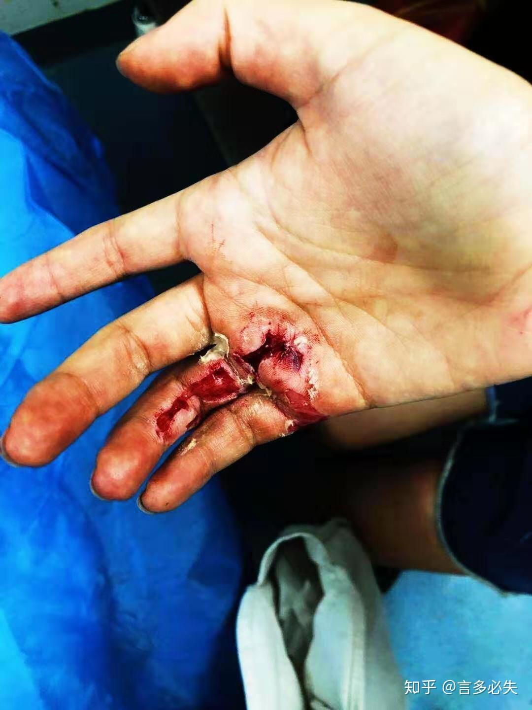 请问这是轻伤还是轻微伤?