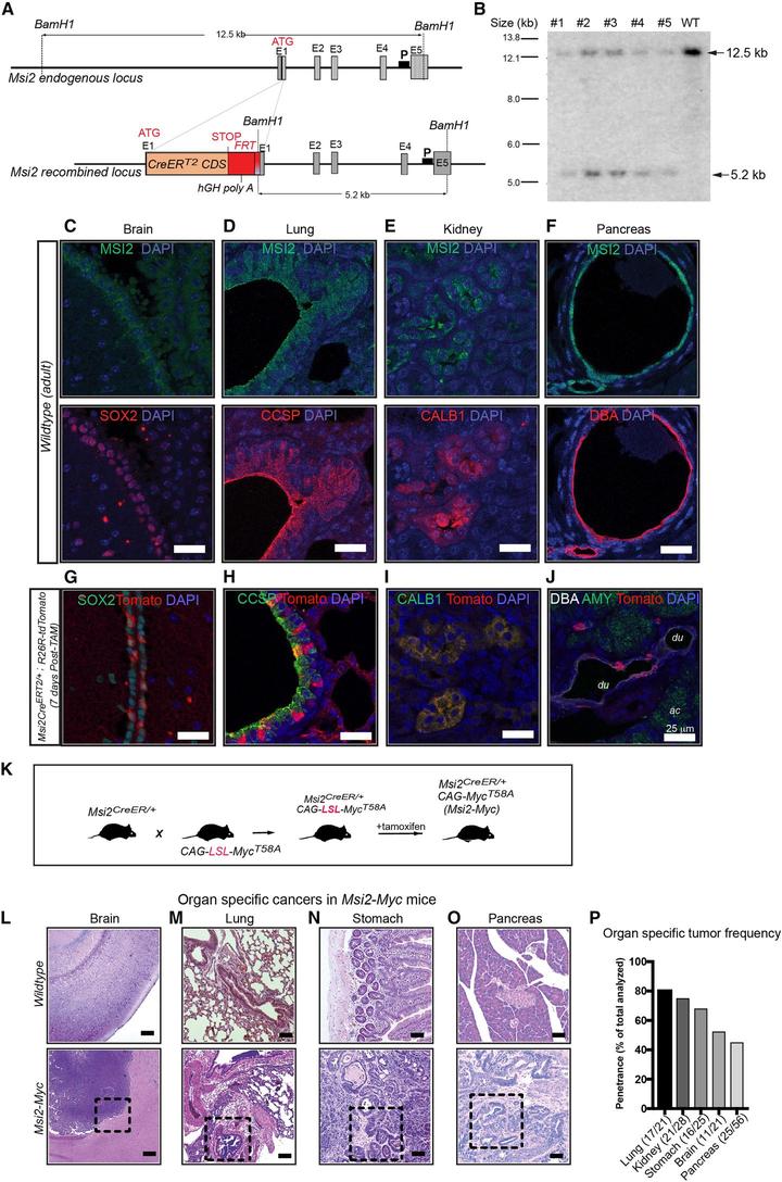 Cancer Cell | 单细胞图谱发现 MSI+ 细胞是胰腺癌不同亚型的共同来源 - 知乎