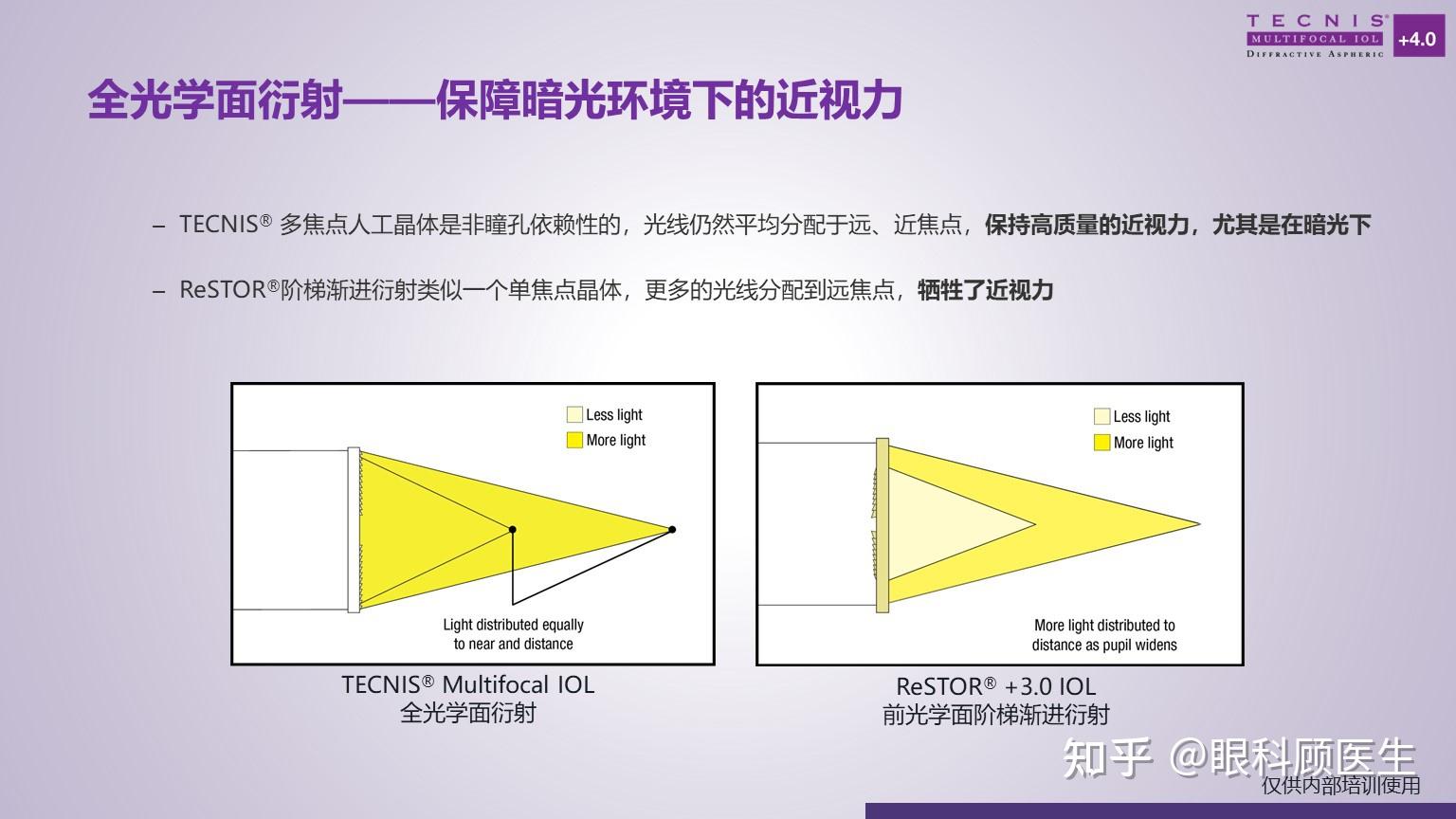 Zmb00 眼力健双焦点人工晶体-ZMB00的特点 - 知乎