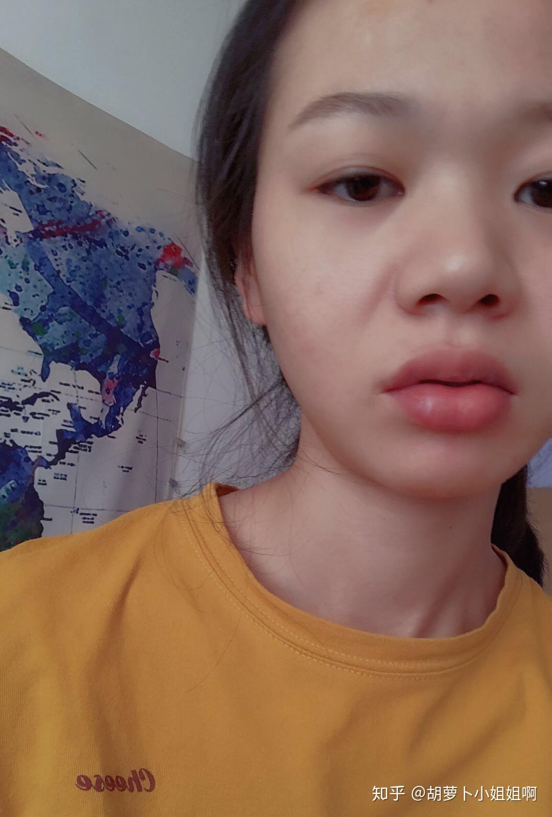 嘴唇厚且翘是什么体验? - 知乎