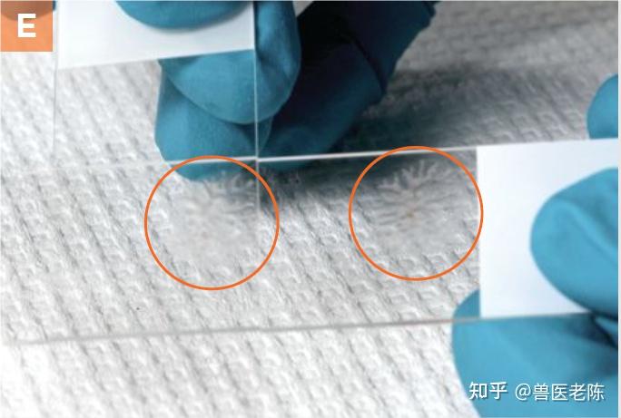 用细针活检法获取细胞学样本 - 知乎
