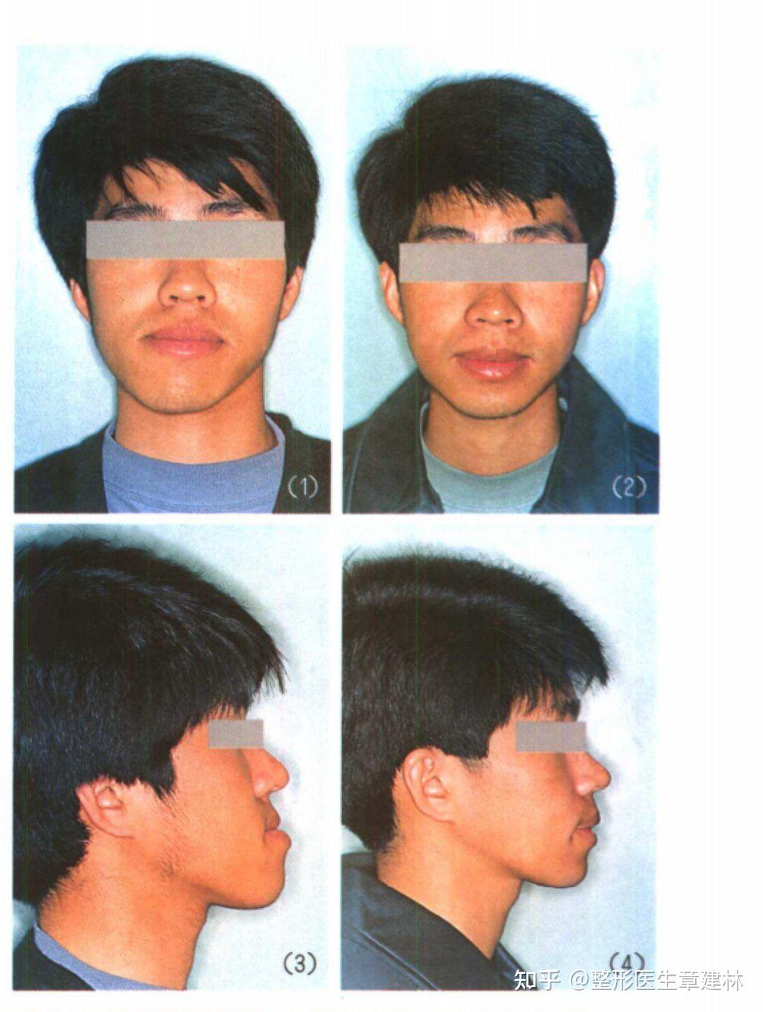 谈一谈地包天给你的人生带来了什么样的影响也谈一