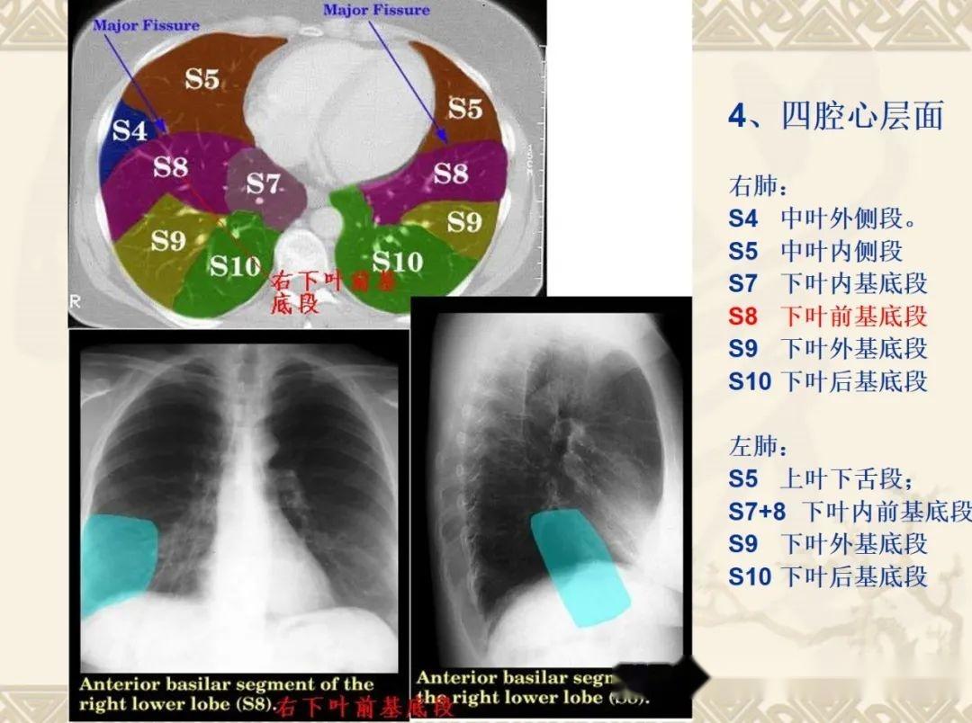 想学ct读片