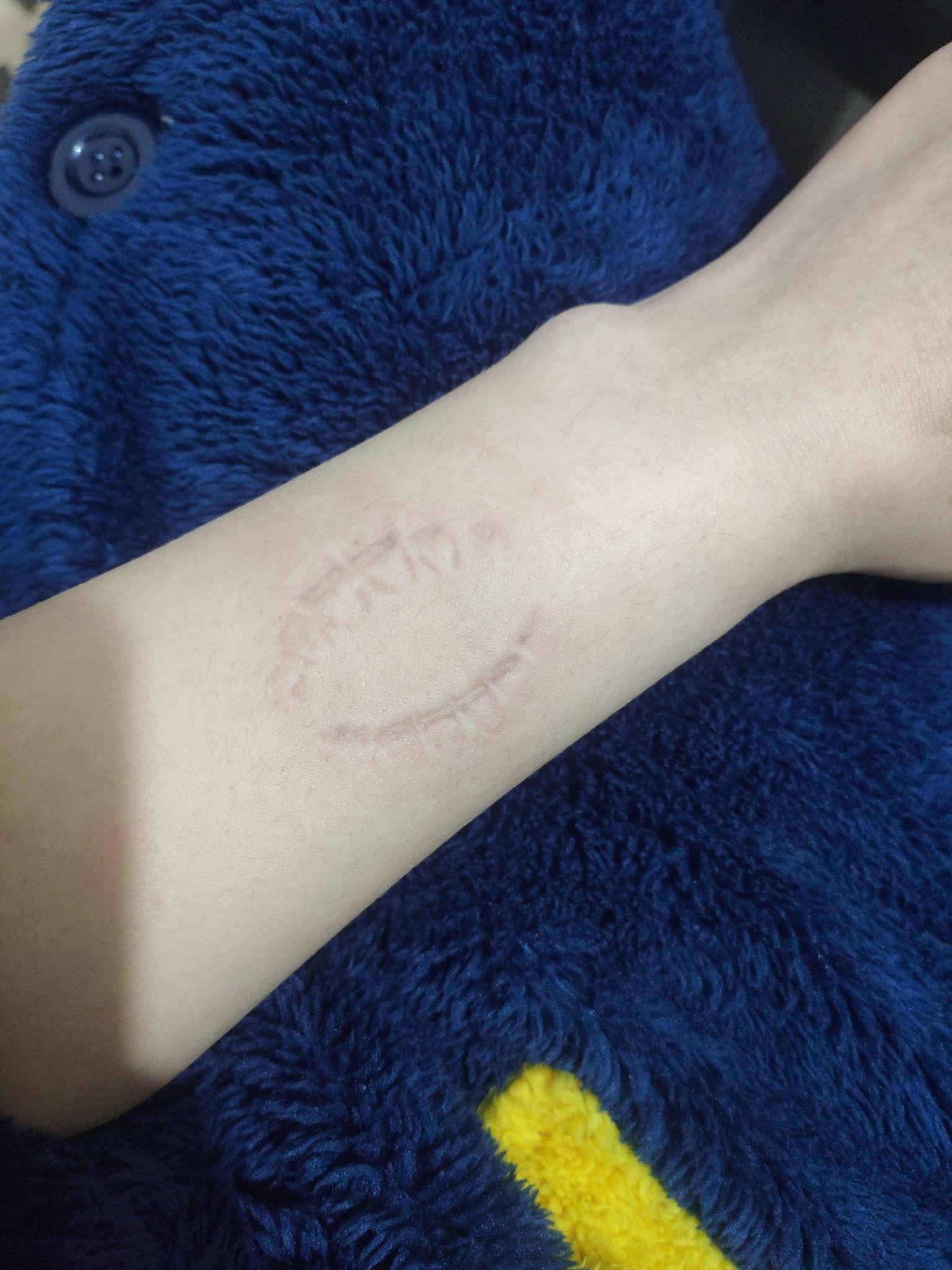 想问纹身真的有纹牙印的吗,成图好看吗? - 知乎