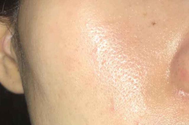 面部出油严重,不要慌张,教你解决脸部出油!备上这件洁面神器