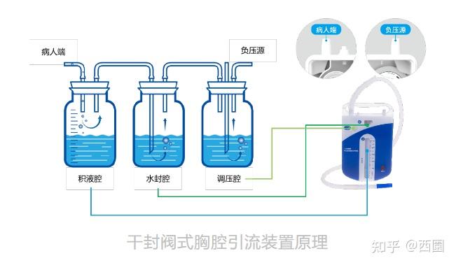 胸腔闭式引流一腔二腔三腔的各自原理 适应症 拔管证? - 知乎