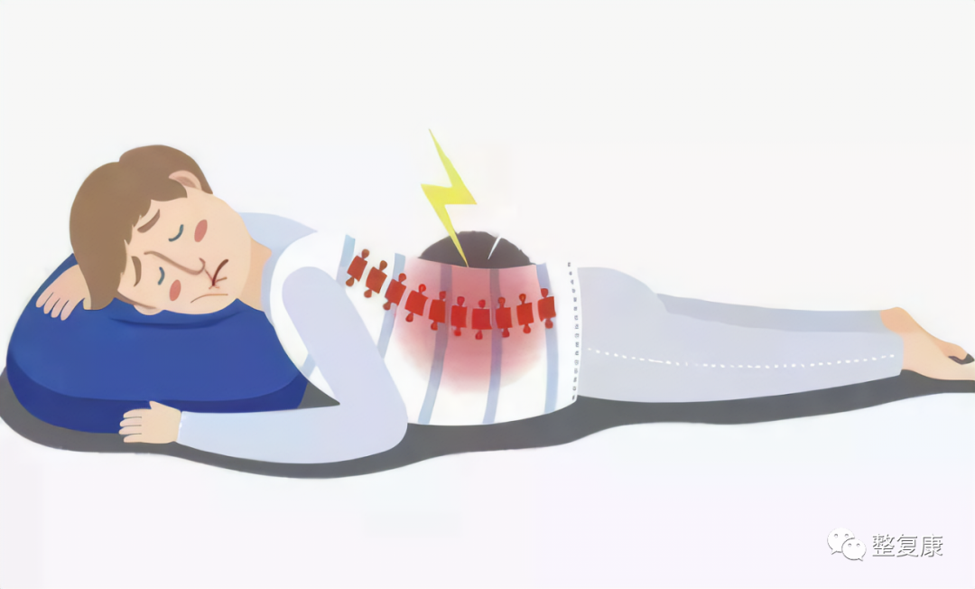 急性腰扭伤是不是完全动不了