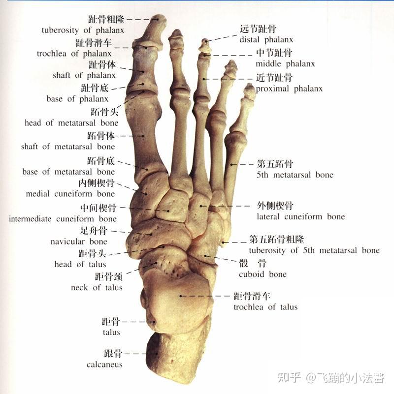 交通事故导致左足骨折,赔偿项目有哪些,能否评定伤残? - 知乎