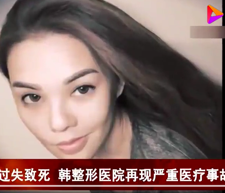 堡狮龙创始人孙女在韩整形身亡类似的悲剧还要再发生多少次